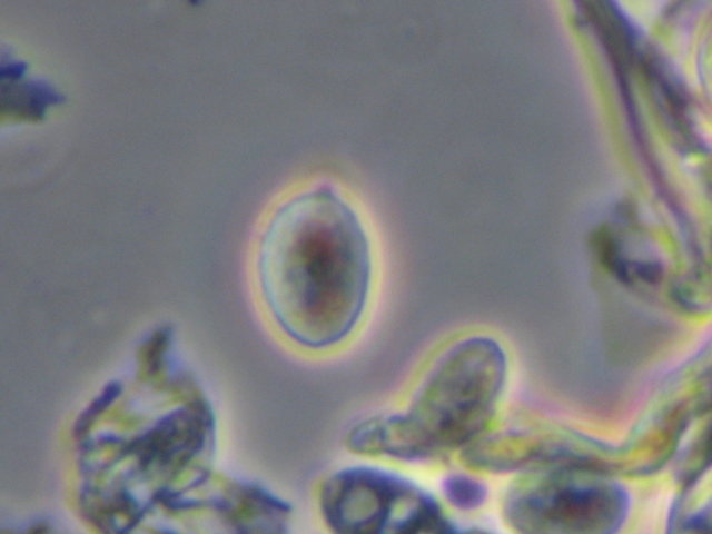 Botryobasidium con spore finemente verrucose